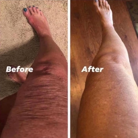 ageLOC® Dermatic Effects™ Body Contouring Lotion/Hibiscus Firming Cream - Picture 3 of 10